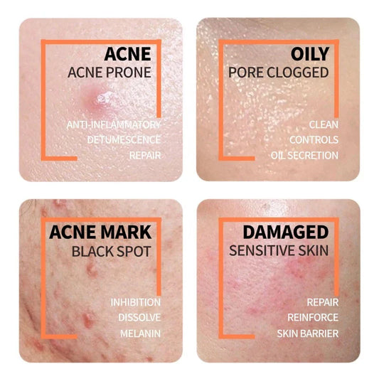 Niacinamide 10% + Zinc 1%