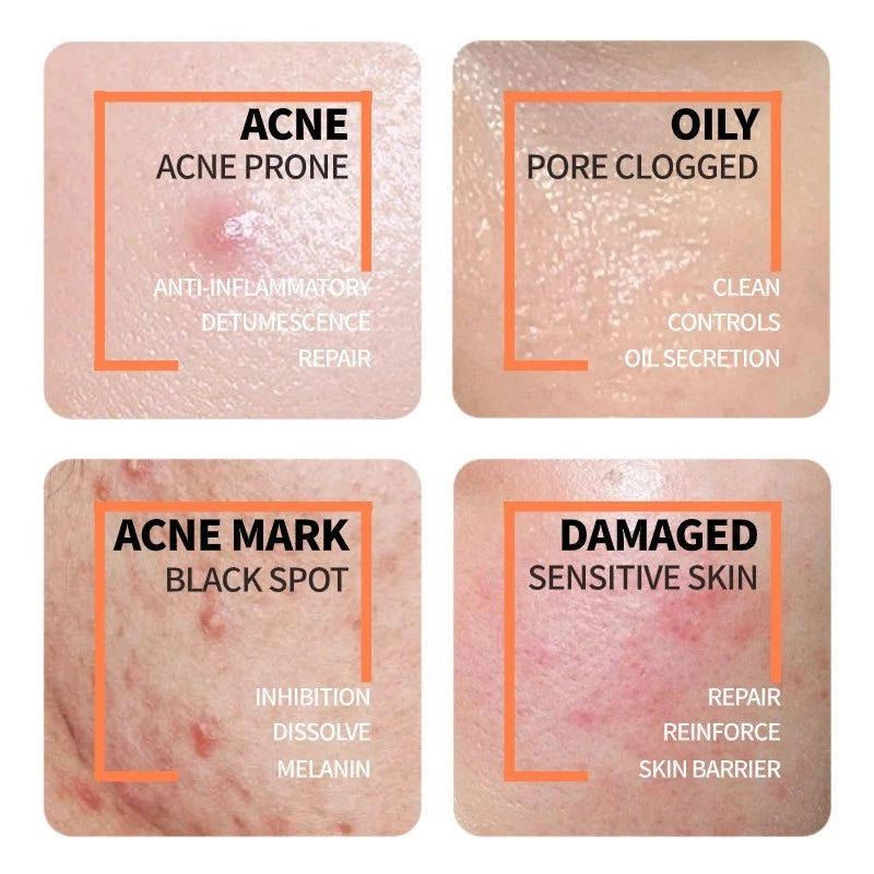 Niacinamide 10% + Zinc 1% (Two Pack)