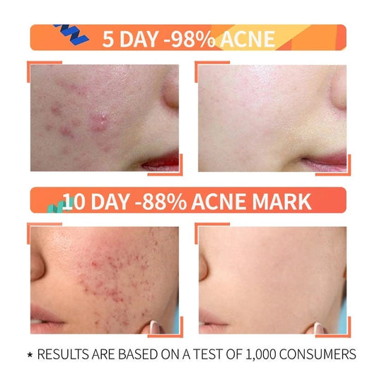 Niacinamide 10% + Zinc 1% (Three Pack)