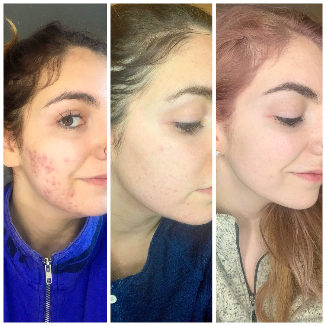 Anti-Aging Combo Set – For Youthful, Radiant Skin