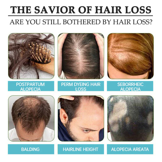 The Ordinary Multi-Peptide Serum for Hair Density