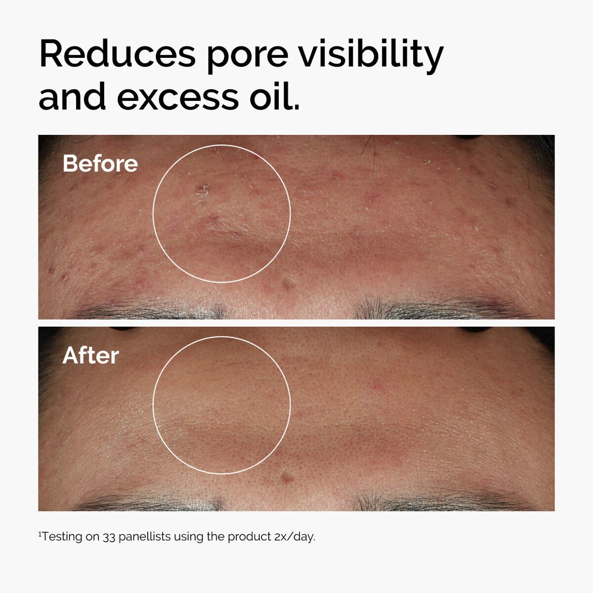 Niacinamide + Glycolic Acid Duo (Solve All Your Skin Problems)