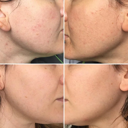 Glycolic Acid 7% Toning Solution – The Ordinary UAE | Exfoliating Toner