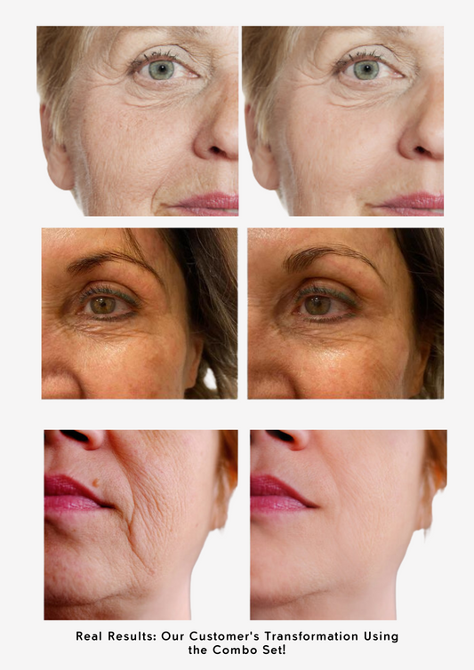 Youthful Skin Combo Set – Reduce Fine Lines & Wrinkles