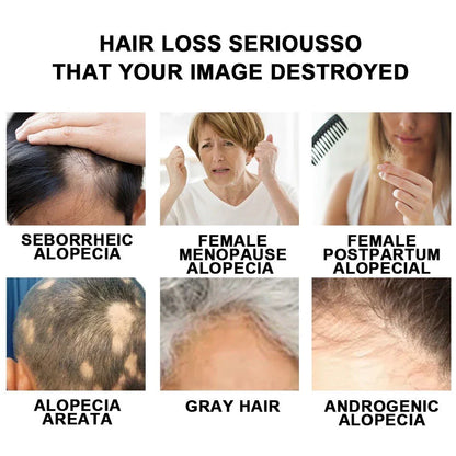 The Ordinary Multi-Peptide Serum for Hair Density