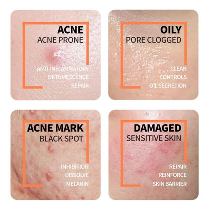 Niacinamide 10% + Zinc 1%