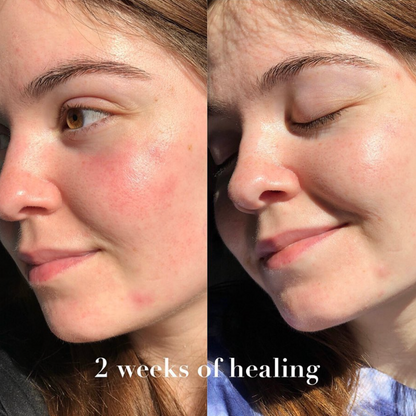 Anti-Aging Combo Set – For Youthful, Radiant Skin