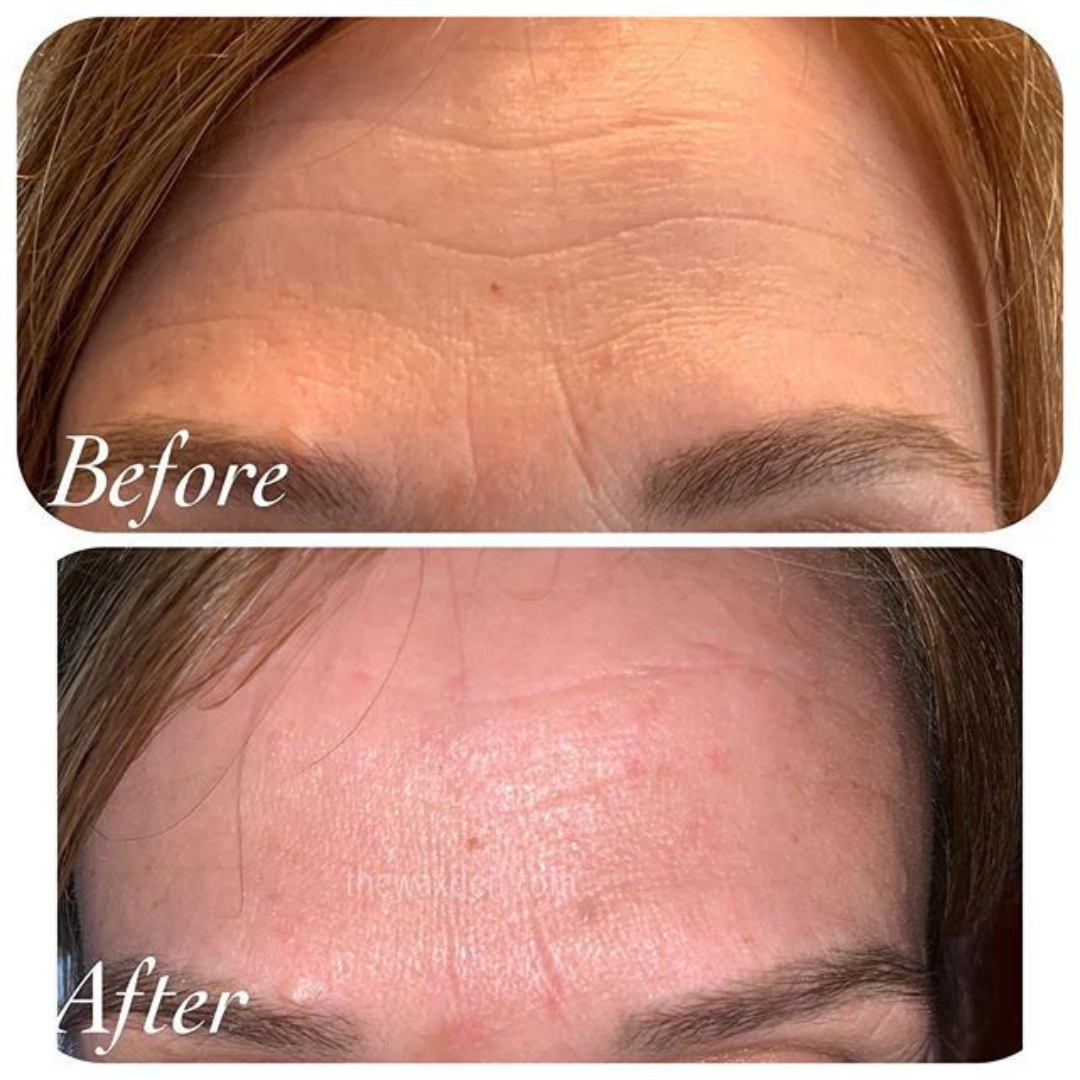 Youthful Skin Combo Set – Reduce Fine Lines & Wrinkles