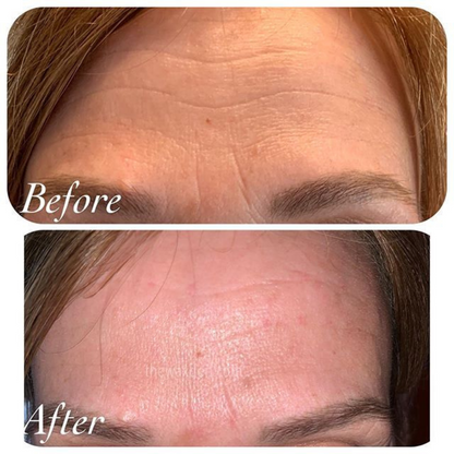 Youthful Skin Combo Set – Reduce Fine Lines & Wrinkles