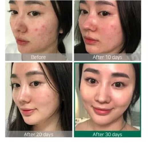 The Ordinary Glow & Clear Skin Bundle – 100% Authentic | Fast UAE Delivery