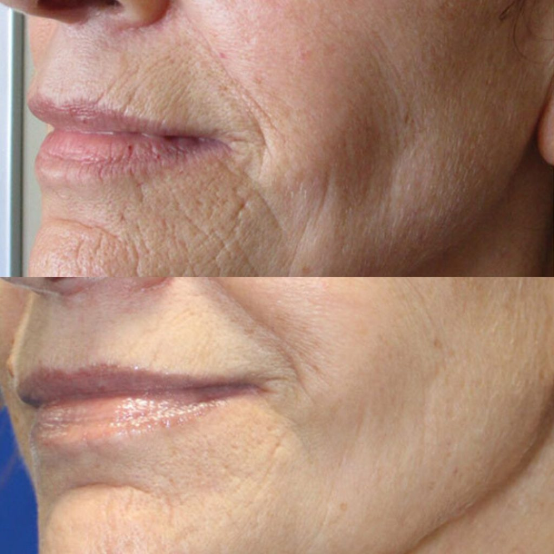 Youthful Skin Combo Set – Reduce Fine Lines & Wrinkles