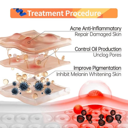 Niacinamide 10% + Zinc 1% (Three Pack)