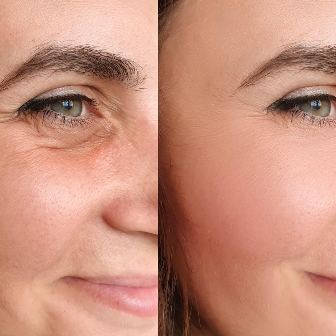 Youthful Skin Combo Set – Reduce Fine Lines & Wrinkles