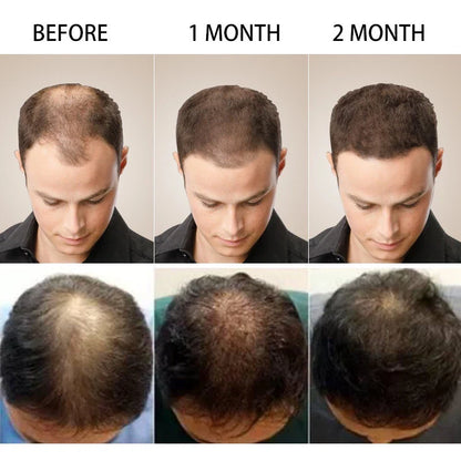 The Ordinary Multi-Peptide Serum for Hair Density