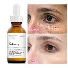 The Ordinary 3IN1 Peelin Vico Skin Care