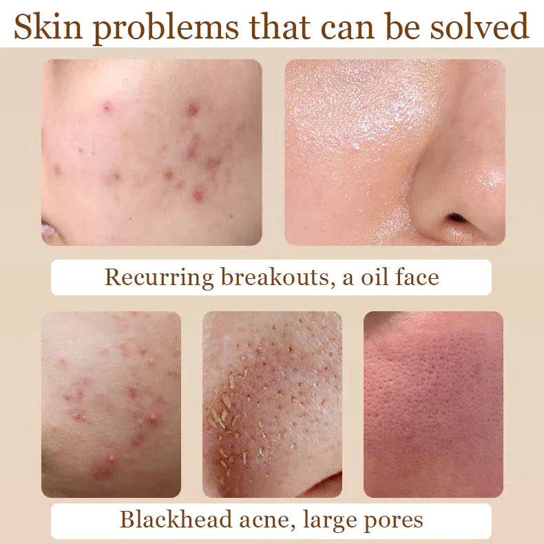 Glycolic Acid 7% Exfoliating Toner 240ml (previously Toning Solution)