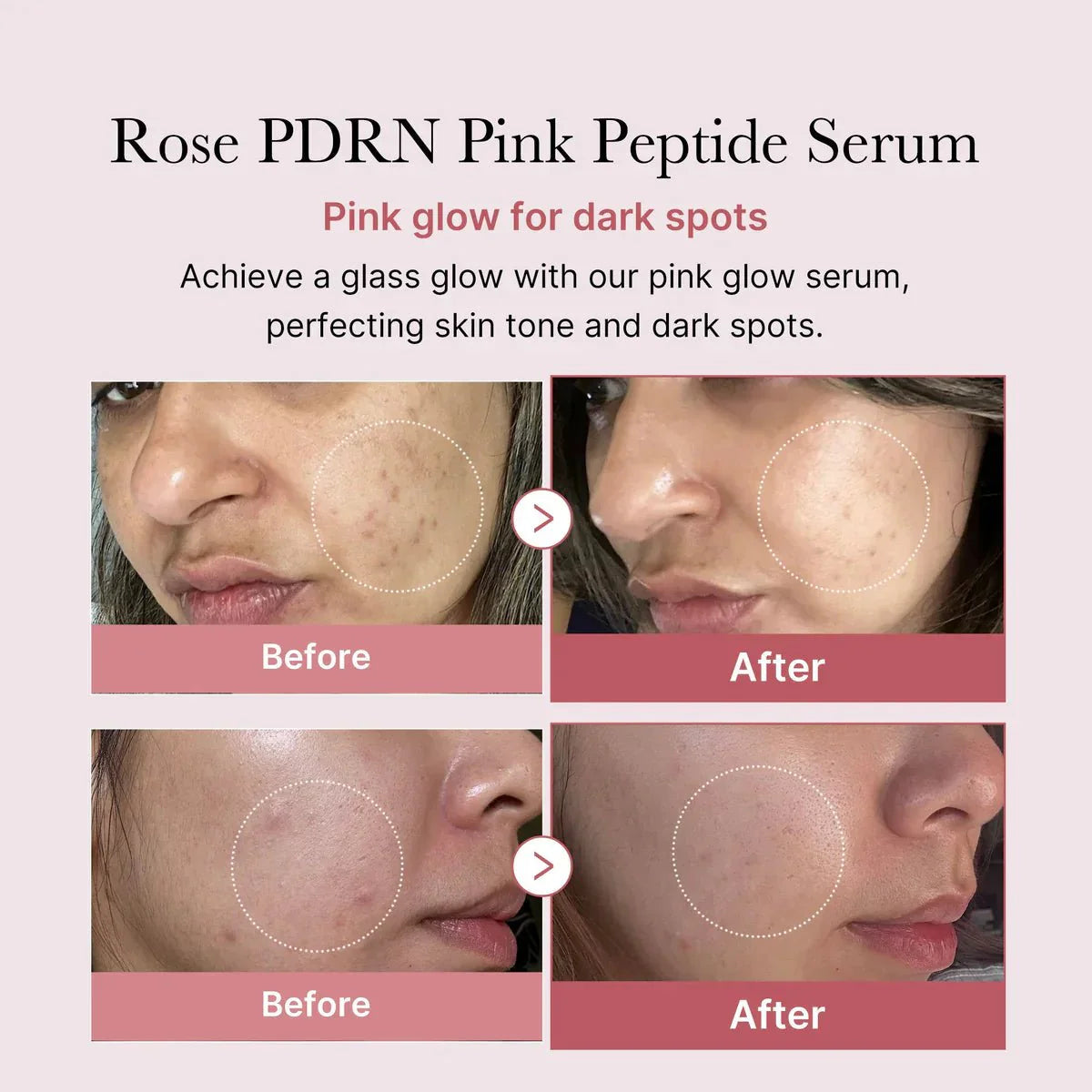 MEDICUBE - PDRN Pink Peptide Serum 30ml | Anti-Aging and Brightening Korean Serum in UAE