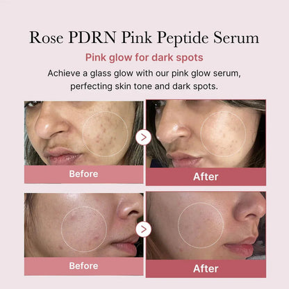 MEDICUBE - PDRN Pink Peptide Serum 30ml | Anti-Aging and Brightening Korean Serum in UAE