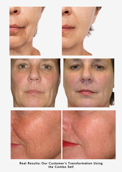 Anti-Aging Combo Set – For Youthful, Radiant Skin