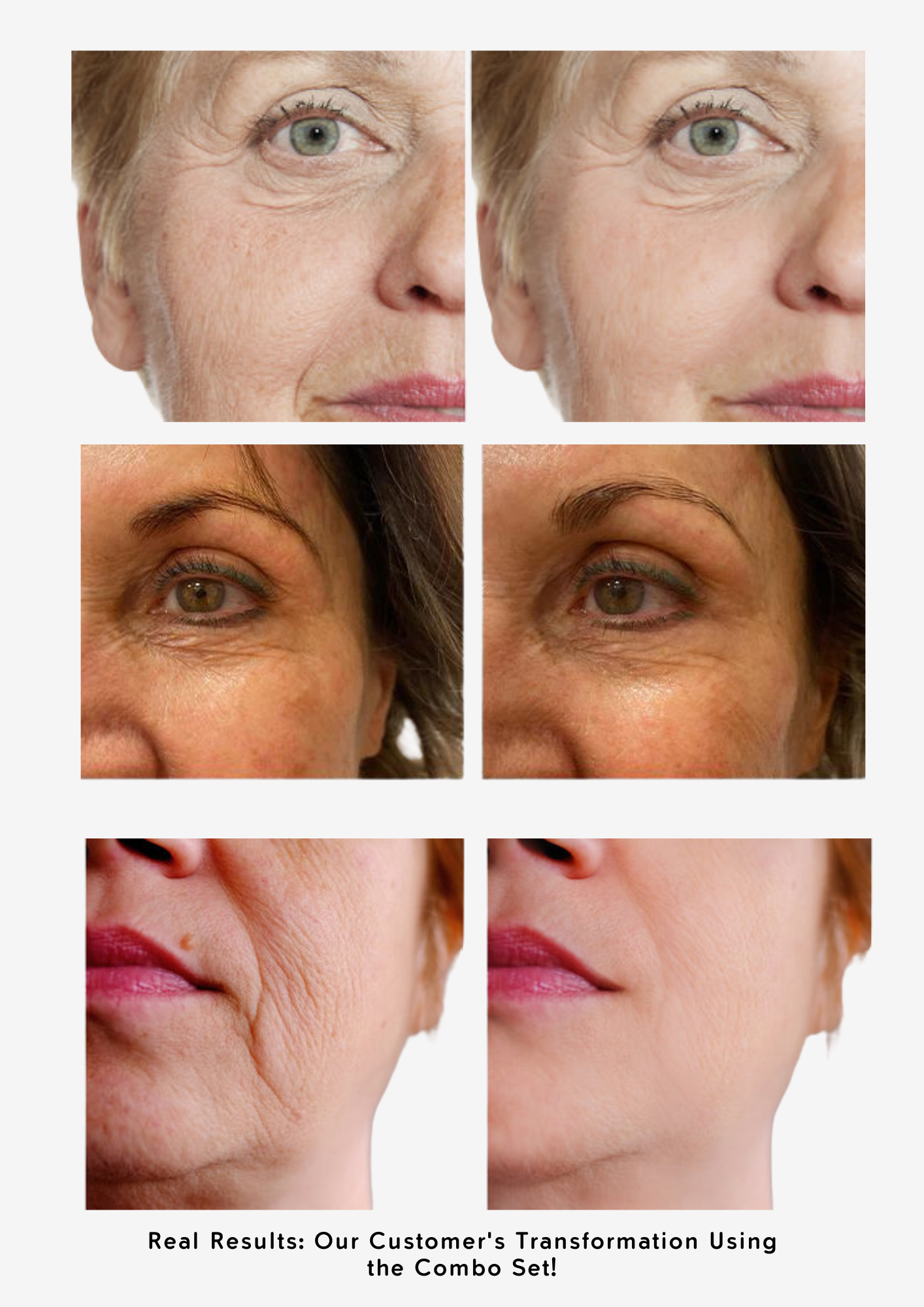 Youthful Skin Combo Set – Reduce Fine Lines & Wrinkles